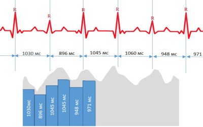 Jak měřit variabilitu srdeční frekvence? Heart Vision (EKG) vs. Hodinky (PPG)