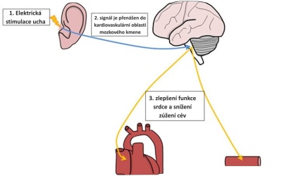 Neinvazivní stimulace bloudivého nervu snižuje aktivitu sympatiku